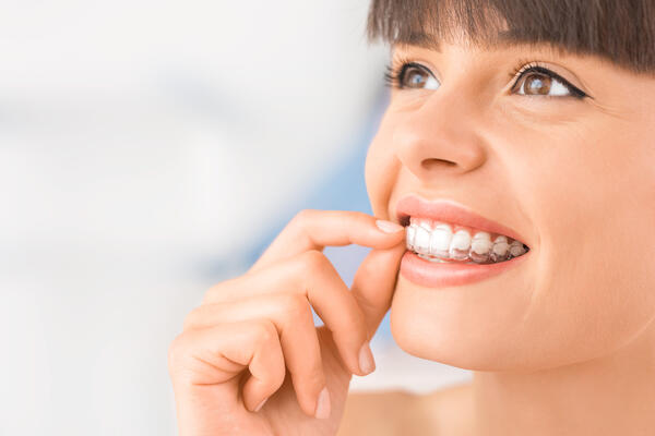 clear aligners for adults